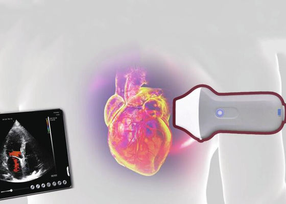 PDI WiFiの無線携帯用超音波の走査器128の要素